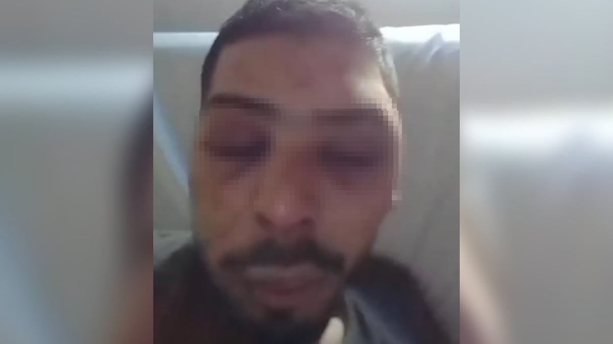 Joven fue atacado a golpes en Entre Ríos: “Me sacaron del auto y me desfiguraron la cara”